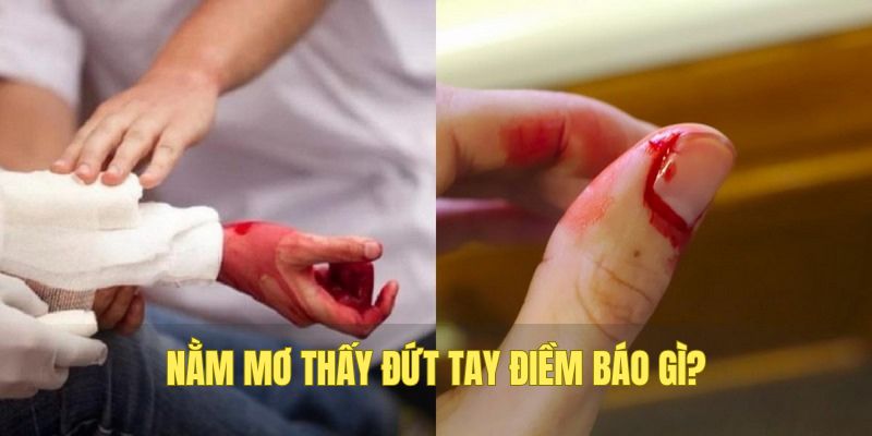 Ý nghĩa khi nằm mơ thấy đứt tay